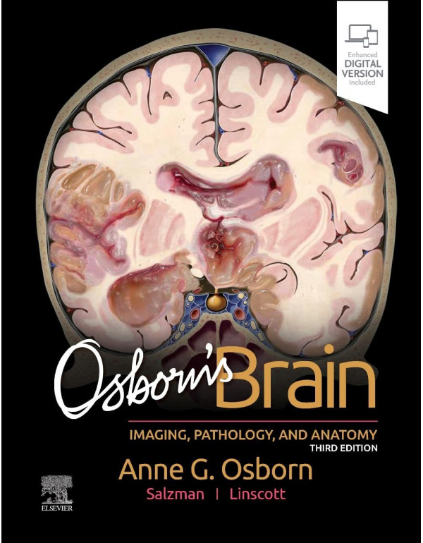 Osborn's Brain *HARDCOVER* 3rd Ed. By Anne Osborn, Luke Linscott, Karen Salzman - {9780443109379} {0443109370}