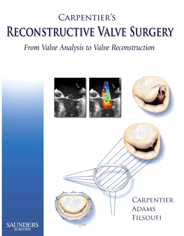 Carpentier's Reconstructive Valve Surgery by Alain Carpentier MD PhD {9780721691688} {0721691684}