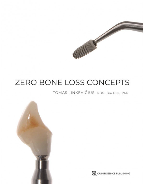 Zero Bone Loss Concepts *HARDCOVER* By Tomas Linkevicius - {9780867157994} {0867157992}