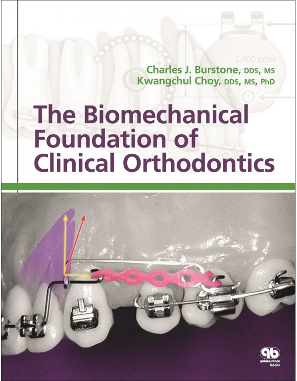 The Biomechanical Foundation of Clinical Orthodontics by Charles J. Burstone, Kwangchul Choy {9780867156515} {0867156511}