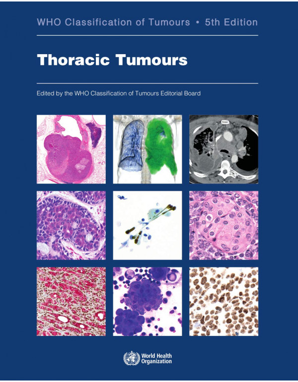 Thoracic Tumours: WHO Classification of Tumours by...