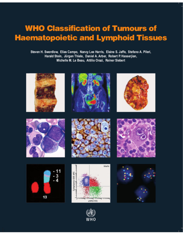 WHO classification of tumours of haematopoietic an...